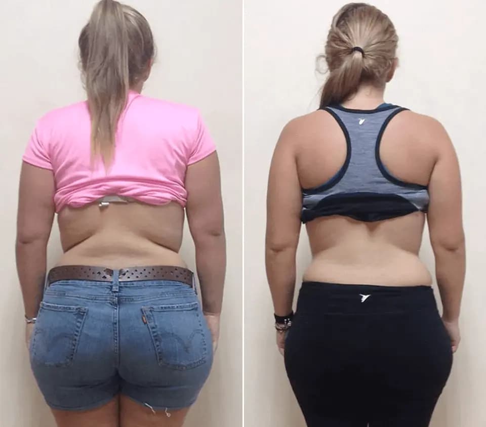 Stacy Miller transformation